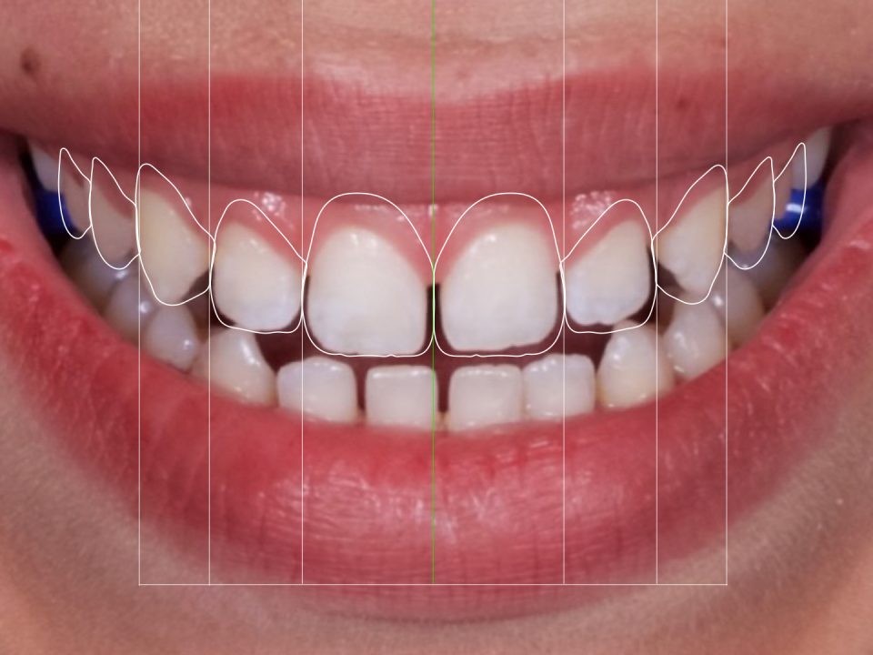 Design do Sorriso